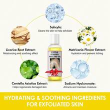Powerful Non-Irritating Exfoliating Oil - Dark Spot Corrector And Dead Skin Remover For Most Effective Whitening And Exfoliation Of Dead Skin With Orange Peeling Oil - Màu vàng - Xem 3