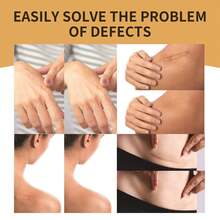 6pcs/Pack Invisible Cover Concealer Stickers, Skin Tattoo Scar Cover Up Waterproof Concealer Patches - Khaki - View 6