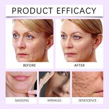 2 piezas de Esencia de Retinol, Suero Facial, Cuidado de la Piel, con Centella, Minimiza los Poros, Suero Anti-Envejecimiento, Reafirma y Nutre la Piel, Brillo Radiante - Blanco*2 piezas - Ver 9