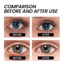 Naturals Instant Eye & Face Lift Rapid Under Eye Bags Wrinkles Puffiness Remover Women And Men In 60s -Temporary Firming & Tightening Treatment - Wrinkle Filler 3pcs - White3PC - View 6