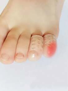 10 piezas-Protectores de silicona para los dedos de los pies con agujero, tapa de dedo transpirable adecuado para correr en casa para damas, protector de dedo transpirable anti-fricción para prevenir ampollas, aliviar la elasticidad del pie, separador de dedos, cubierta protectora para el dedo meñique, callos, corrector de ampollas, protector de juanete