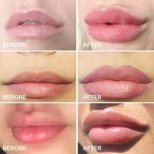 Lips Enhancer Plumper Device Lips Silicone Fish Shape L Pout Mouth Tool Sexy Lip Mouth - 1 - 查看 6