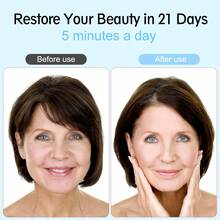 Led Light Facial Massager, Skin Care Tool For Face, Neck Care - Pink - View 8