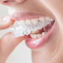 2 bandejas transparentes para clareamento e alisamento dos dentes, acessórios de higiene bucal sem odor para uso noturno, aliviam o ranger dos dentes