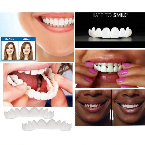 Kit de decoração para clareamento dental Smile, 4 peças, 2ª geração, fácil de usar