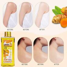 Brand New Upgraded Turmeric Oil, Facial And Body Massage Oil, The Top Choice For Massage In Spa And For Relaxation. Turmeric Nourishing Essential Oil, Facial And Body Massage Oil, Deeply Nourishes, Hydrates And Moisturizes. - 黃色 - 查看 11