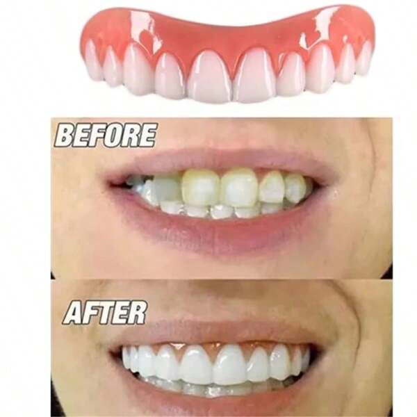 4 peças/conjunto de novos aparelhos dentários superiores e inferiores não porosos, dentaduras simuladas, decoração de dentes com sorriso perfeito