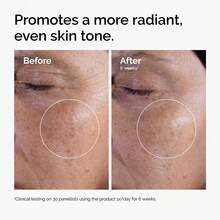 El Tónico Exfoliante con Ácido Glicólico al 7% de The Ordinary, tónico diario para aclarar y suavizar que ayuda a lograr un tono de piel talla grande uniforme - 240ml - Ver 2
