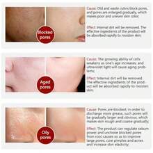 Suero facial para el cuidado de los poros, esencia facial para minimizar los poros agrandados, para cerrar los poros, reducir los poros + aliviar la sequedad + control del aceite + firmeza + hidratación, nuevo empaque - como en la foto - Ver 5