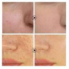 Suero facial para el cuidado de los poros, esencia facial para minimizar los poros agrandados, para cerrar los poros, reducir los poros + aliviar la sequedad + control del aceite + firmeza + hidratación, nuevo empaque - como en la foto - Ver 6