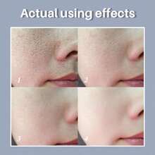 Suero facial para el cuidado de los poros, esencia facial para minimizar los poros agrandados, para cerrar los poros, reducir los poros + aliviar la sequedad + control del aceite + firmeza + hidratación, nuevo empaque - como en la foto - Ver 4