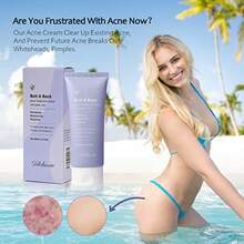 Butt Acne Clearing Treatment Maximum Strength Body Cream For Back Buttocks Thigh And Chest Acne Removal Skin Clearing Lotion For Men And Women Foaming Cleanser For Bacne And Cystic Acne - as pic - View 2