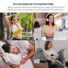 Butt Acne Clearing Treatment Maximum Strength Body Cream For Back Buttocks Thigh And Chest Acne Removal Skin Clearing Lotion For Men And Women Foaming Cleanser For Bacne And Cystic Acne - as pic - View 6