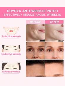 5 Miếng dán trán bằng silicon có thể tái sử dụng - Miếng dán mặt bằng silicon Miếng dán mịn có thể tái sử dụng cho trán, vết chân chim, cổ Miếng dán làm mịn da mặt Chăm sóc da khi ngủ, tập thể dục và yoga, Nhẹ, thoáng khí và không nhăn khi đeo - trắng - Xem 6