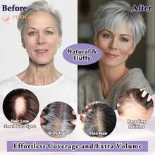 Grey Hair Toppers For Women With Thinning Short Hair Topper Fluffy Pixie Cut Wiglets Hairpieces 7 * 7inch Large Coverage Synthetic Topper For Women01 - C-7*7Saltandpepper - View 2