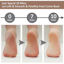 1 Electric Foot Dead Skin Remover, Electric Foot Grinder, Electronic Foot File, Creative Electronic Foot File, Household Exfoliating Tool, Rechargeable Foot Callus Remover Foot File, Professional Foot Care Kit Dead Skin Remover Foot Massager, Perfect Gift