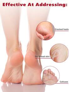 10 件 = 5 包足部去角质膜，去角质，去除老茧，死皮，老茧去除剂，玫瑰足膜，适用于干裂的双脚，足部去角质膜，男女足部去角质膜，节日礼物 - 白色 - 查看 4