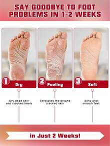 10 件 = 5 包足部去角质膜，去角质，去除老茧，死皮，老茧去除剂，玫瑰足膜，适用于干裂的双脚，足部去角质膜，男女足部去角质膜，节日礼物 - 白色 - 查看 3