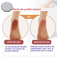 Lima Eléctrica para Pies con Pantalla, Removedor de Callos y Exfoliante, Discos Redondos Reutilizables y Desinfectables - Rosa - Ver 7