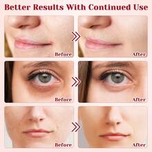 Dragon Blood Cream Lady Cream Placenta Essence Facial Cream Retinol Essence Facial Cream Moisturizing And Moisturizing - 彩色 - 查看 6