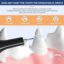 Pet Oral Care Dentistry Household Portable Tartar Removal Ultrasonic Dental Cleaner - 白色 - 查看 6
