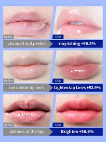 1pc 7g Vaseline Original Lip Therapy, Deep Conditioning Moisturizing Anti-Cracking, High Purity Micro-Crystalline + Vitamin E, Smooth & Soft Texture, Moisturizing, Fading Lip Lines, Lip Balm Suitable For Sensitive Skin & All Skin Types, Daily Use - Lipstick 7g Original - View 5