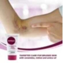 Arnica Bruise Cream With Vitamin K - Moisturizer For Bruising On Arms, Legs & Hands - 4.5 Oz - 淡紫色 - 查看 6