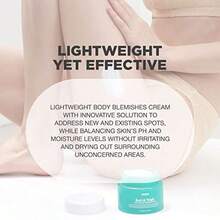 Butt Acne Cream Buttocks Acne Lotion For Body Blemishes Body Acne Cream Formulated With Natural Formula Butt Acne Clearing Treatment Lotion Butt Acne Spot Cream Targeting Stubborn Blemishesm1 - as pic - View 4