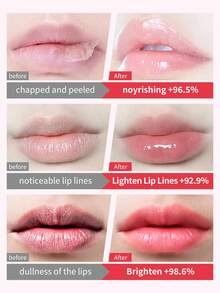 Vaseline 1支7克凡士林玫瑰润唇膏，提亮肤色，保湿滋润，减少皱纹，改善肤色，蕴含玫瑰精油+甜杏仁油+啫喱质地，柔滑滋养，持久留香，唇部护理，女士日常妆前打底，便携装