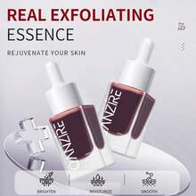 1 Chai 30ml Tinh chất trị tàn nhang, serum dưỡng da mặt, làm mờ vết nám, làm sáng da, chống oxy hóa, làm dịu da, chứa 10% Niacinamide (Cũng có sẵn: Tinh chất nghệ và tẩy tế bào chết) - Màu hồng gỉ - Xem 4