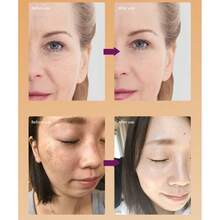 1 Chai 30ml Tinh chất trị tàn nhang, serum dưỡng da mặt, làm mờ vết nám, làm sáng da, chống oxy hóa, làm dịu da, chứa 10% Niacinamide (Cũng có sẵn: Tinh chất nghệ và tẩy tế bào chết) - nghệ - Xem 12
