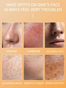 1 Chai 30ml Tinh chất trị tàn nhang, serum dưỡng da mặt, làm mờ vết nám, làm sáng da, chống oxy hóa, làm dịu da, chứa 10% Niacinamide (Cũng có sẵn: Tinh chất nghệ và tẩy tế bào chết) - nghệ - Xem 9