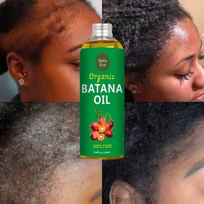 [1 瓶巴塔纳油精华液] 1 瓶 - 成人巴塔纳油护发精华液，3.99 盎司/118 毫升 - 适合中性发质的保湿液体配方，滋养保湿