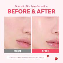 Faded Brightening And Clearing Serum | Reduces Discoloration Post-Blemish Marks Scars Spots Contains Kojic Acid Niacinamide Dermatologist-Tested Vegan Cruelty-Free Fl Oz