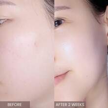 Faded Brightening And Clearing Serum | Reduces Discoloration Post-Blemish Marks Scars Spots Contains Kojic Acid Niacinamide Dermatologist-Tested Vegan Cruelty-Free Fl Oz