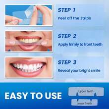 Whitening Kit, Teeth Whitening Sts, Tooth White Sts Pack For 14 Treatments, On Enamel, Easy To Use Home Tooth Whitening Kit, 5D Technology Teeth Whitening Kit 76654 - 1 - View 7