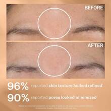Almohadillas exfoliantes diarias de revelación avanzada StriVectin, visiblemente alisan y iluminan la piel, reducen los puntos negros, 60 unidades