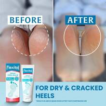 Flexitol Rescue Heel Balm - Foot Visible Results In 1 Day - Cracked Heels And Very Dry Feet - 25 Percent Urea Intense Hydration - Clinically Proven - Suitable Diabetics - 56g