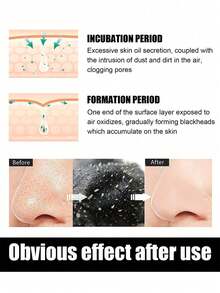 10 pezzi di strisce rimuovi punti neri, strisce per i pori del naso, maschera detergente rimovibile, toppe per la pulizia dei pori, cura della zona T, sblocca istantaneamente i pori per rimuovere punti neri e impurità, adatto per uomini e donne con pelle grassa