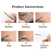 Kit de eliminación de puntos negros y granos 4 piezas con extractor de espinillas, acné y comedones en nariz y rostro, conjunto de eliminación de puntos blancos de acero inoxidable