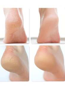 2pcs Gel Foot Mask Leg Warmers For Women, Dead Skin Removal, Moisturizing Silicone Foot Peeling Exfoliating Leg Warmers