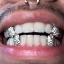 4 Peças Grillz de Moda Hip Hop Personalizado, Acessório de Joia com Incrustação de Cobre e Zircônia Brilhante, Presente para Artistas de Rap e Hip Hop, Grillz Unissex