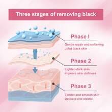 1 件私密肌肤亮白精华液，适用于私密部位、腋窝、大腿、臀部、乳头 - 专业亮肤保湿霜，适用于肤色不均、色素沉着，母亲节礼物