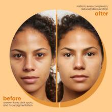 Turmeric Duo Magic! Foaming Cleanser (Deep - Cleans, Brightens) + Turmeric Tablets (Wellness - Boosting). 2 - In - 1 Skincare & Health Power, Unlock Radiant Skin And Vitality! ,Skin Care,Brightening Face Turmeric Products,Skincare Set✨