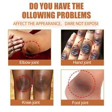 30ml Papaya Seed Skin Care Oil Lightens Dark Spots Bends Joints Elbows Brightens Skin And Moisturizes Skin Care Oil - Mixed Plants - View 5