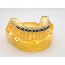 2PCS One Step Braces With Fashion Power Chain Metal Bracket And Wire - Easy Stall Orthodontist Dental Student Practice (Pink) - Black - View 9