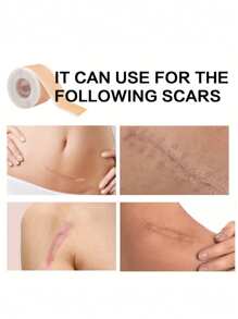 Invisible Silicone Scar Covering Tape, Reusable Silicone Scar Covering Tape - For C-Section, Acne, Burns, Surgery And Stretch Marks - Smooth, Moisturizing Light Beige Solution, Improvement Patch | Flexible Application | Multifunctional Skin Care For Surgery, Burns, Postpartum Scars, Fragrance-Free, Personal Care Must-Have, Tattoo Accessory