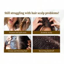 Hollow Tooth Button Design, Deep Cleansing Scalp, Anti-Lice And Anti-Itching, Relieves Psoriasis, Suitable For Boys And Girls, Multi-Functional Hair Care Comb, One Comb For Multiple Uses, Energy Meridian Massage, Improves Scalp Health