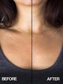 可重复使用胸垫硅胶透明去除贴片面部皮肤护理胸垫美容和个人护理工具亲肤胸部皱纹贴片，自粘式隔夜胸部贴片，使您的皮肤焕发活力 - 减少女性和女孩的衰老迹象