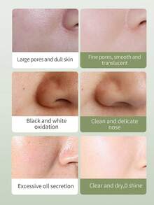 绿茶泥净化面膜 140g，富含芦荟、烟酰胺和透明质酸，可去除黑头、减少皱纹、滋养、保湿、改善整体肤色、最佳抗氧化剂、让肌肤更年轻、适合所有肤质